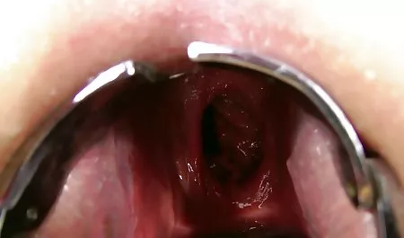 يصرخ في جنس عرب محارم ألم الشرج الأول